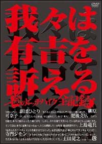 ��X�͗L�g��i����`��̃q�b�`�n�C�N�S�L�^�`