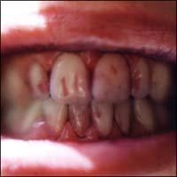 �g�[�N�E���C�N�E�u���b�h