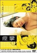 痙攣　けいれんを観る
